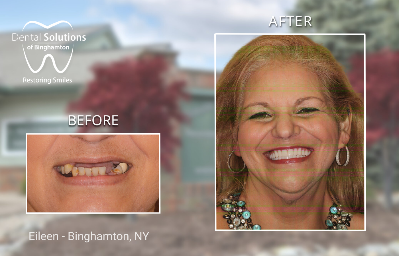 Eileen - Binghamton, NY